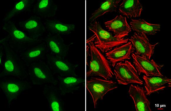 KMT1A/SUV39H1 Antibody - BSA Free