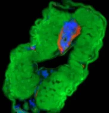 LOXL1 Antibody