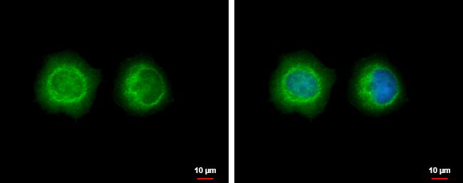 LYK5 Antibody