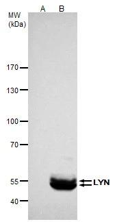 Lyn Antibody