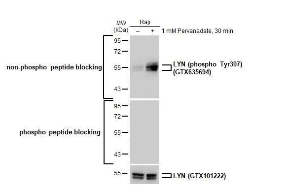 Lyn Antibody
