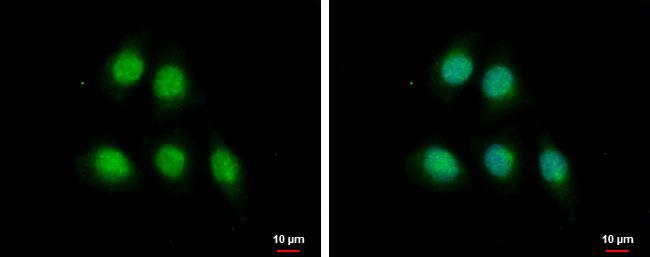 MAGEA1 Antibody - BSA Free