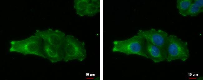 MAGEA4 Antibody