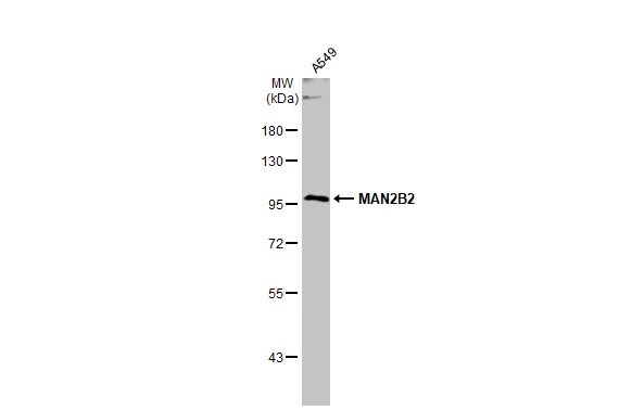 MAN2B2 Antibody