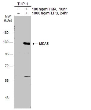 MDA5 Antibody