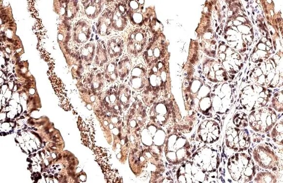 MDM2/HDM2 Antibody