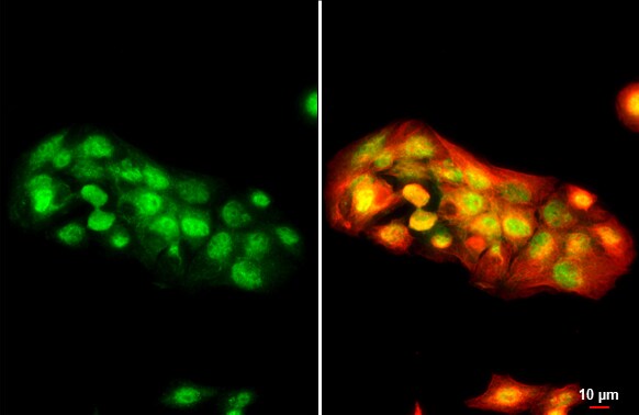 MDM2/HDM2 Antibody