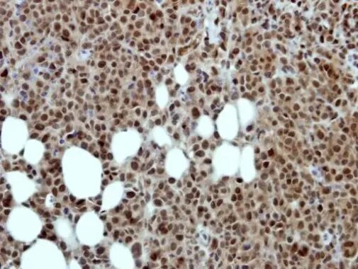 MED17 Antibody