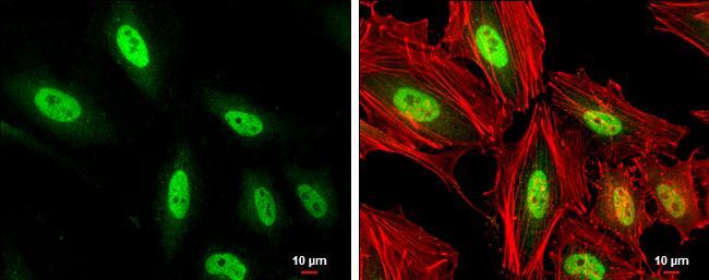 MEF2C Antibody - BSA Free