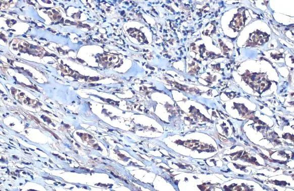 MEF2C Antibody - BSA Free
