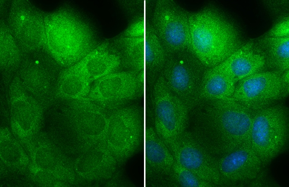 MEK1 Antibody