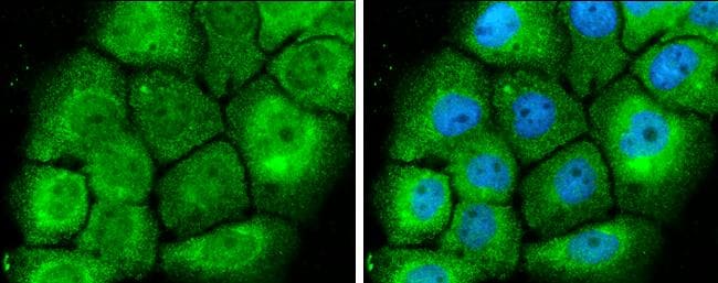 MEK1 Antibody