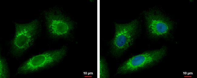 Methyltransferase like 6 Antibody - BSA Free