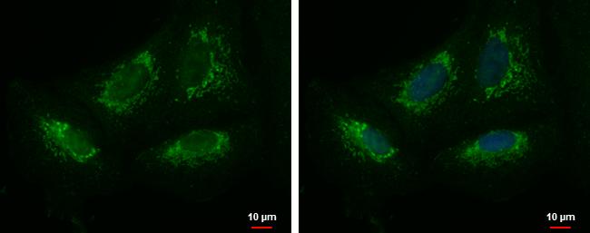 Mitochondrial ribonuclease P protein 3 Antibody
