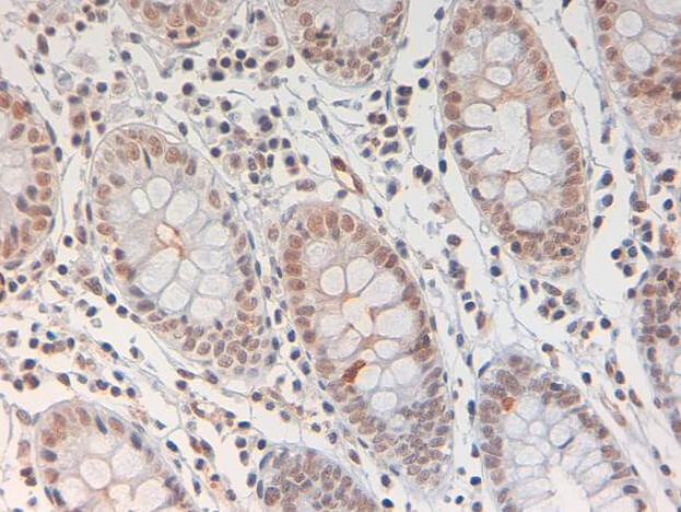 STAT3 [p Tyr705] Antibody