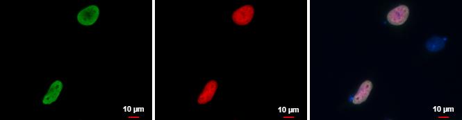 RFP Antibody