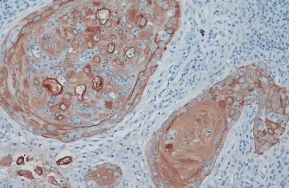 KRTHA3B Antibody