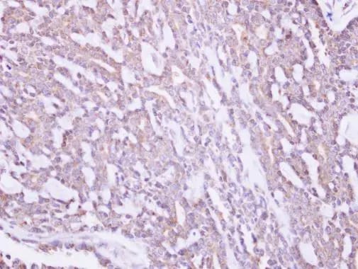 MRPS10 Antibody
