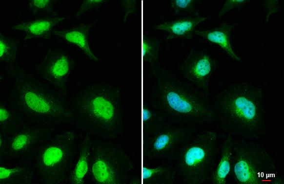 MSH3 Antibody - BSA Free