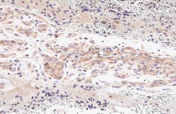 MTHFD2 Antibody