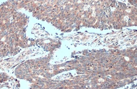 MTHFD2 Antibody