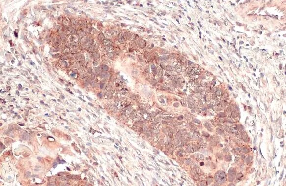 mtTFA Antibody