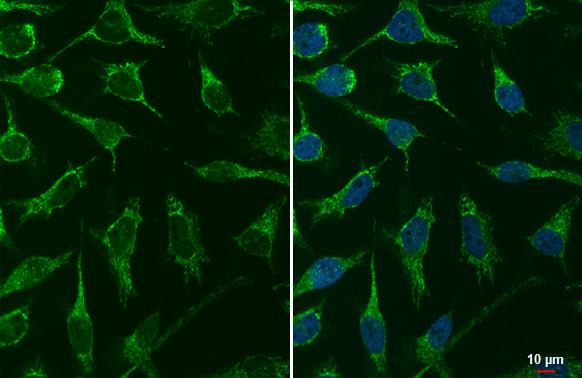 mtTFA Antibody