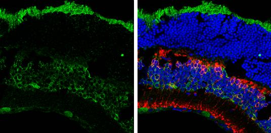Musashi-2 Antibody