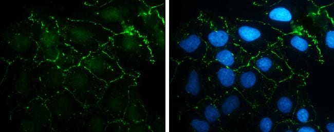 N-Cadherin Antibody