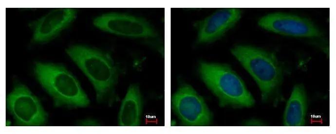 NAA10 Antibody - Azide and BSA Free