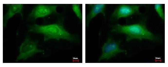 NCAPH Antibody - BSA Free
