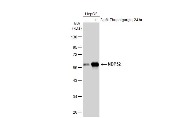 NDP52 Antibody