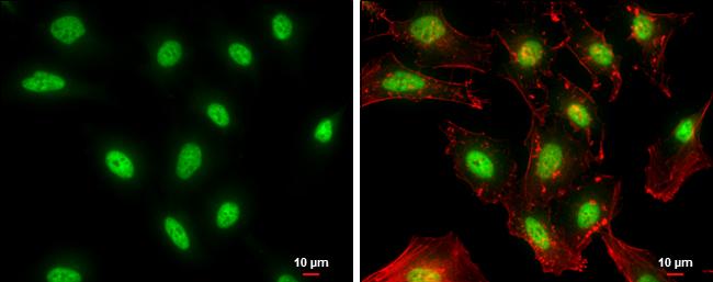 NFYB Antibody