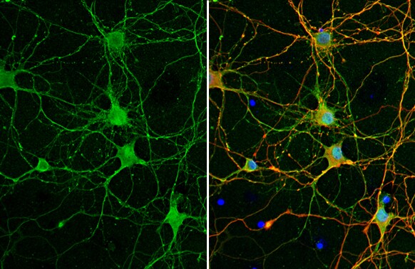 NMDAR2A Antibody