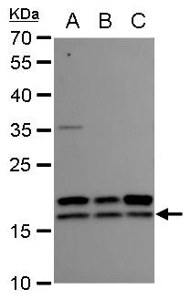 NM23-H2/NME2 Antibody