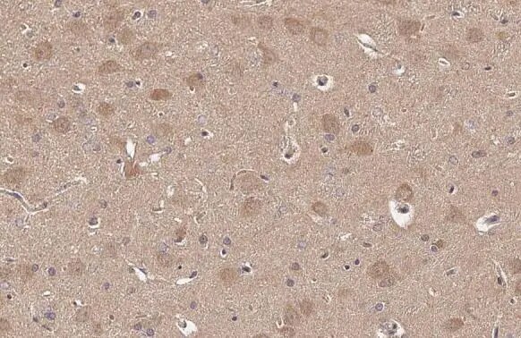 ARC/NOL3 Antibody