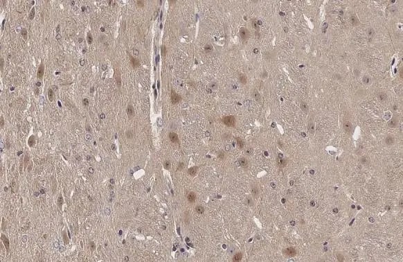 ARC/NOL3 Antibody