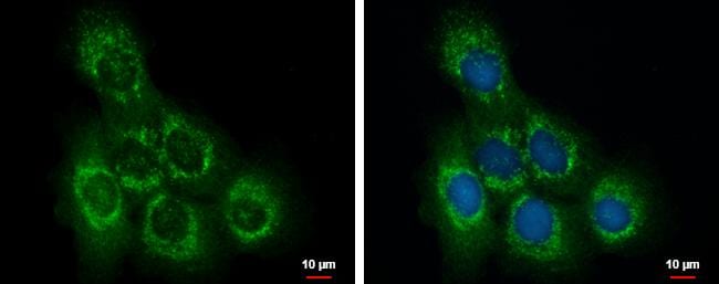 OCRL Antibody - BSA Free