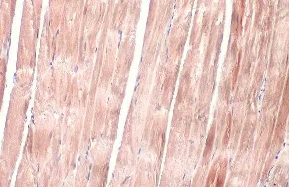 OGDH Antibody