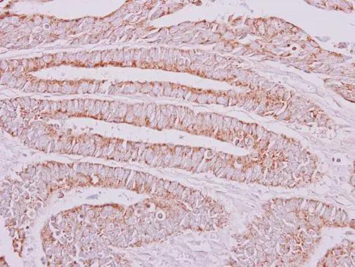 OXSM Antibody