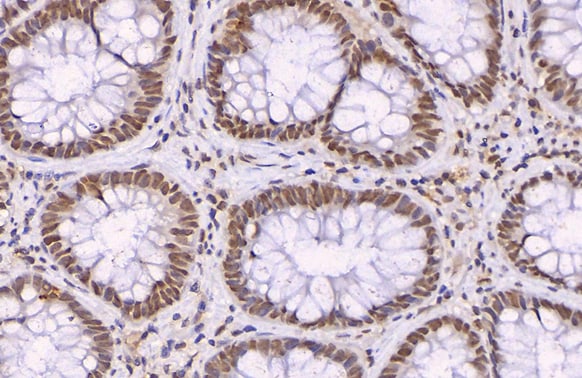 p21/CIP1/CDKN1A Antibody
