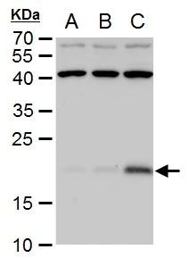 p21/CIP1/CDKN1A Antibody - BSA Free