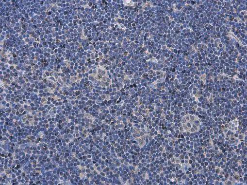 P2X7/P2RX7 Antibody - BSA Free