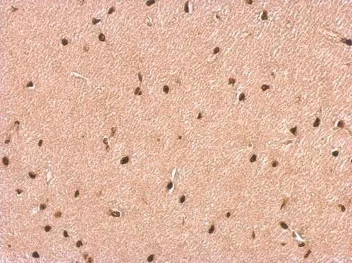P2X2/P2RX2 Antibody - BSA Free