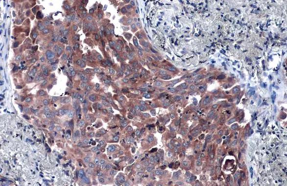 P4HA1 Antibody