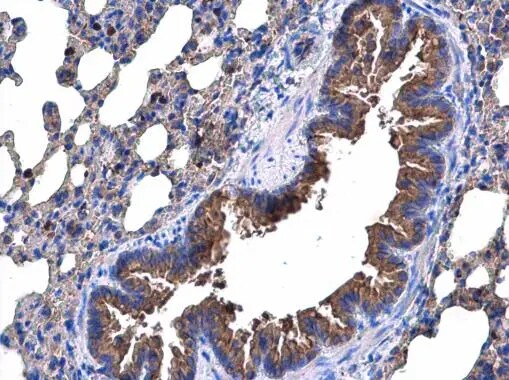 p53R2 Antibody
