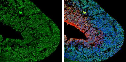 NGFR/TNFRSF16/p75NTR Antibody