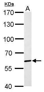 PAK1 Antibody - BSA Free