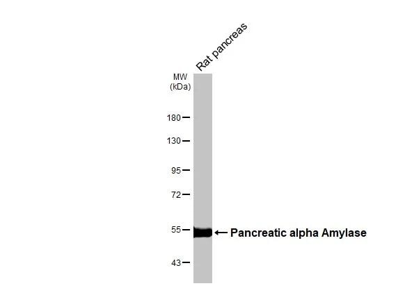 Pancreatic Amylase Beta Antibody - BSA Free