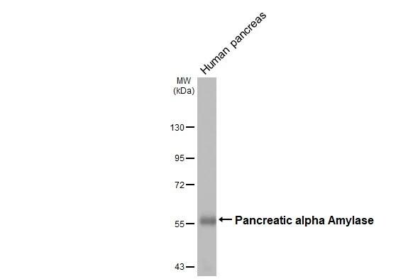 Pancreatic Amylase Beta Antibody - BSA Free